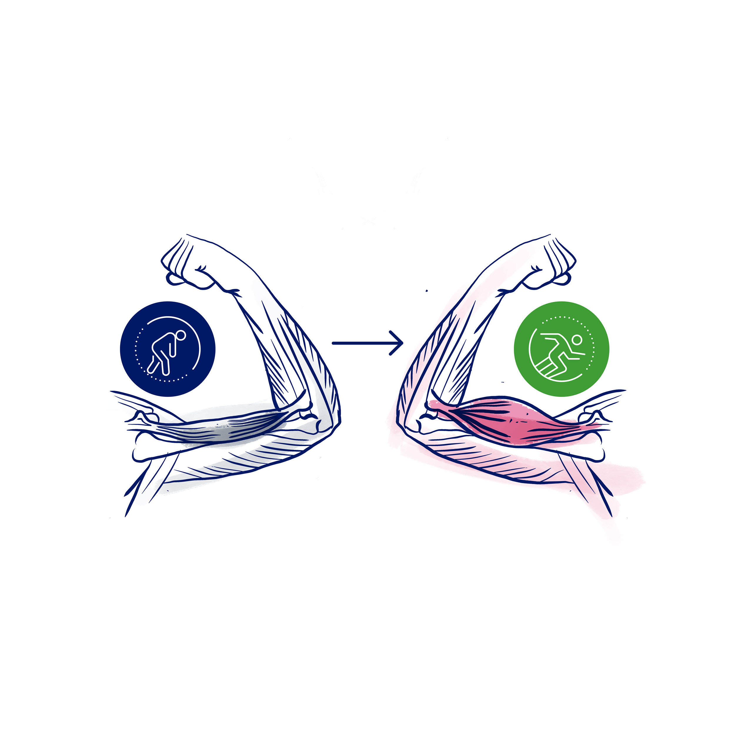 Examples of impaired muscle size and function in type 2 diabetes