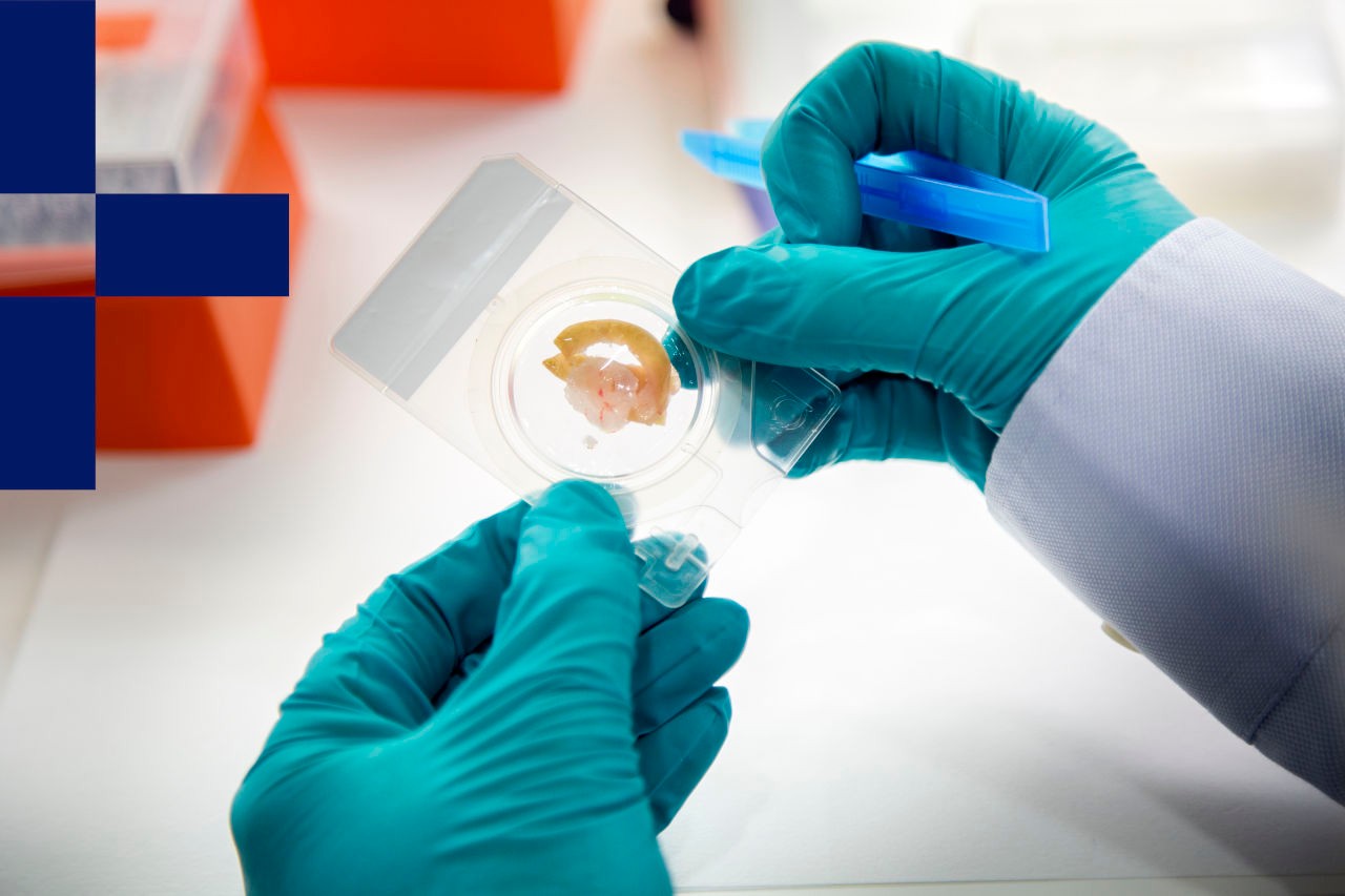 Image of a hand holding a petri dish