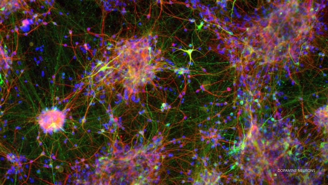 Graphic of nerves grouping together